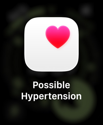 Apple Watch Ultra 3, titanium case, natural colour, possible hypertension notification, pink heart in white box, band, Trail Loop, blue/bright blue colour